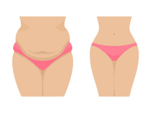 fat freezing makes it easy to lose inches